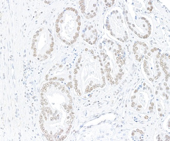 Rabbit anti-ARID1A/BAF250 Recombinant Monoclonal Antibody