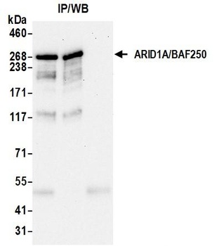 Rabbit anti-ARID1A/BAF250 Recombinant Monoclonal Antibody