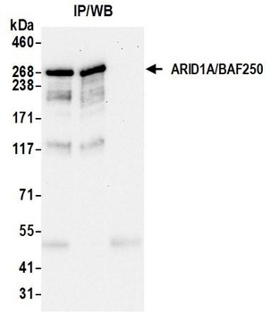 ARID1A/BAF250 Antibody