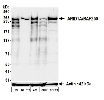 ARID1A/BAF250 Antibody