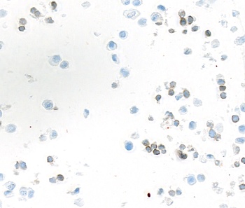 Rabbit anti-LAG3 Recombinant Monoclonal Antibody