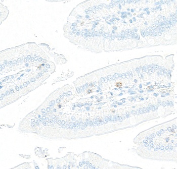 Rabbit anti-LAG3 Recombinant Monoclonal Antibody