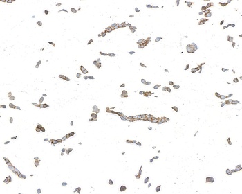 Mouse Desmoglein 3 Monoclonal Antibody