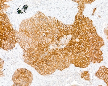 Mouse Desmoglein 3 Monoclonal Antibody