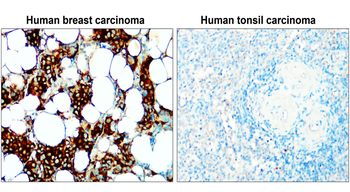 Fatty Acid Synthase/FASN Antibody