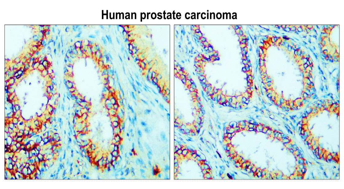 Claudin-1 antibody