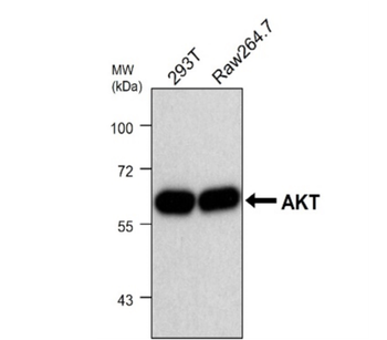 AKT Mouse Monoclonal Antibody