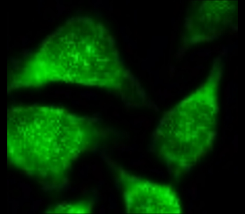AKT Mouse Monoclonal Antibody