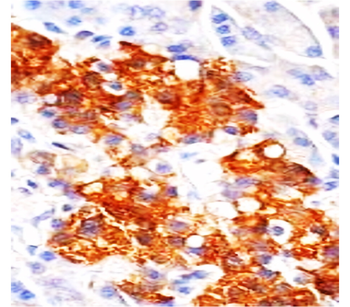 AKT Mouse Monoclonal Antibody