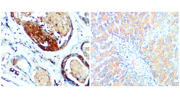p38 MAPK Rabbit Polyclonal Antibody