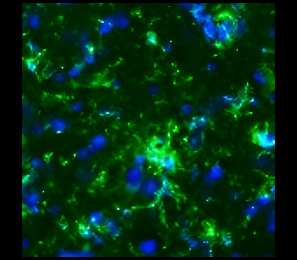 CD11b antibody