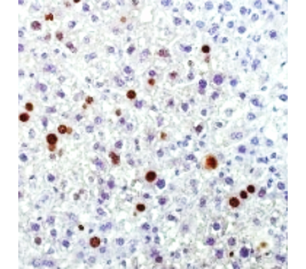 Ki67 [SP6] Rab-monoclonal Antibody