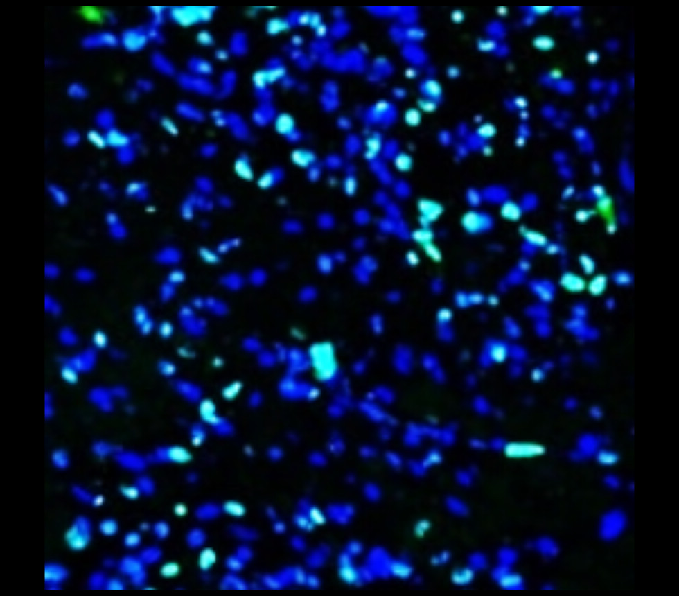 Ki67 [SP6] Rab-monoclonal Antibody