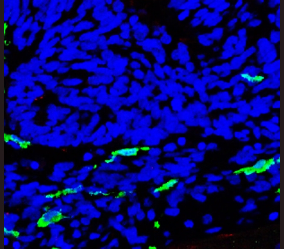 Iba1, monoclonal Antibody