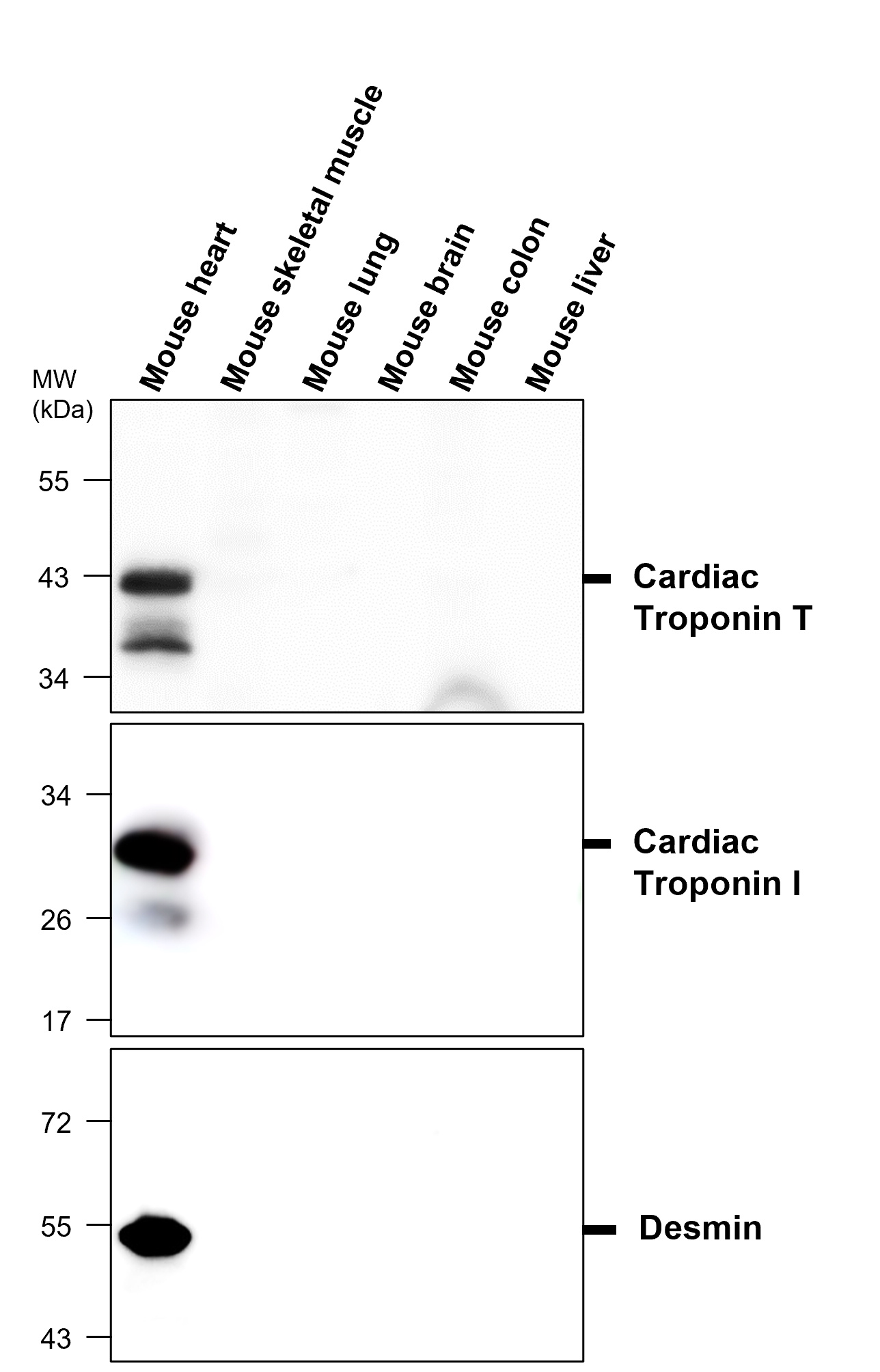 Desmin, monoclonal