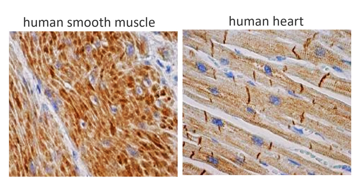Desmin, monoclonal