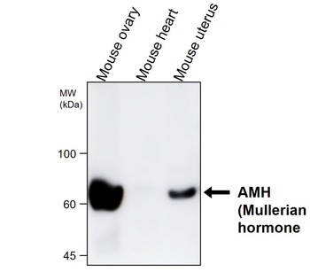 Mullerian Hormone Rabbit Polyclonal Antibody