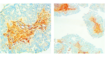Mullerian Hormone Rabbit Polyclonal Antibody