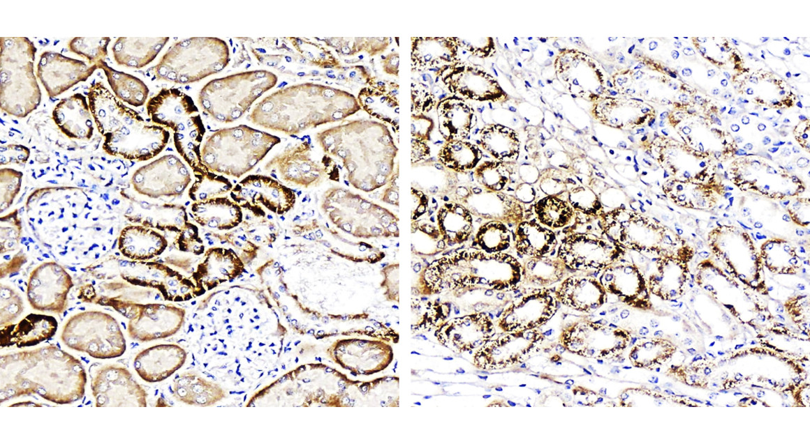 FNDC5/irisin Antibody