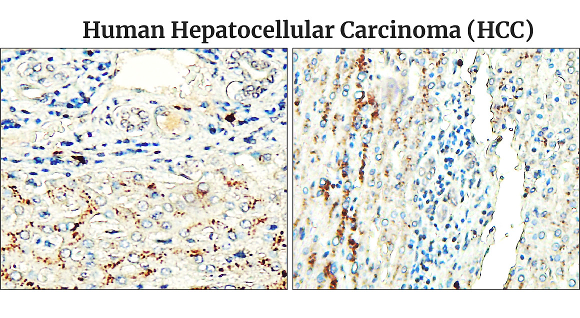 Fibronectin 1/FN1 (C-term) Antibody