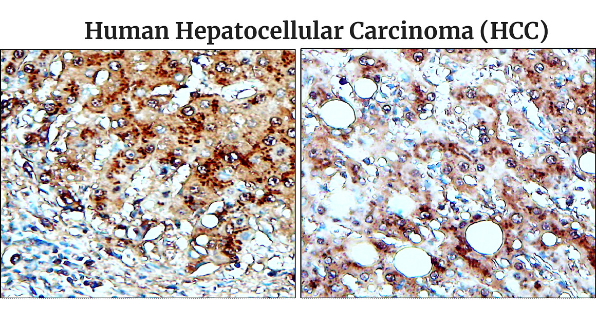 Fibronectin 1/FN1 (C-term) Antibody