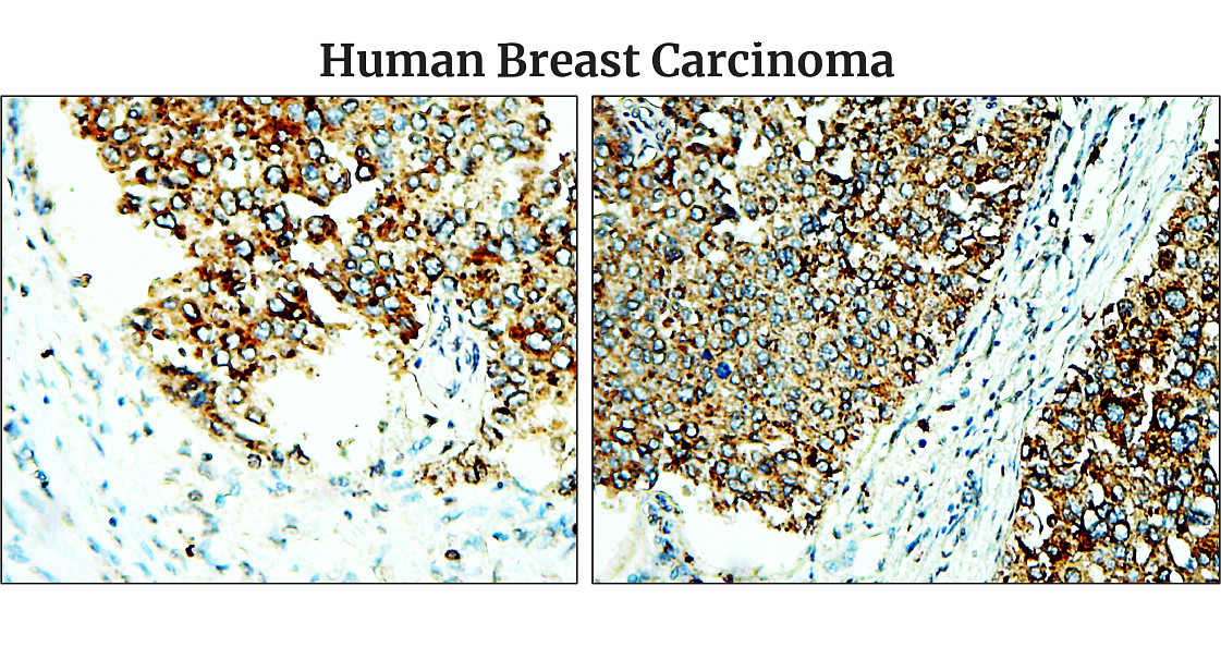 Fibronectin 1/FN1 (C-term) Antibody