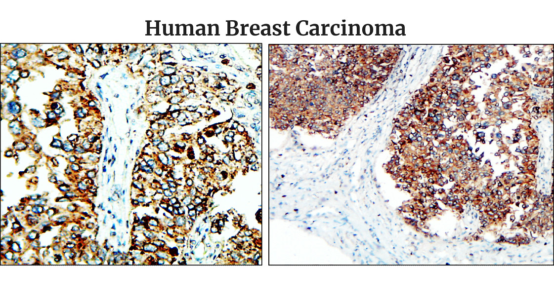 Fibronectin 1/FN1 (C-term) Antibody