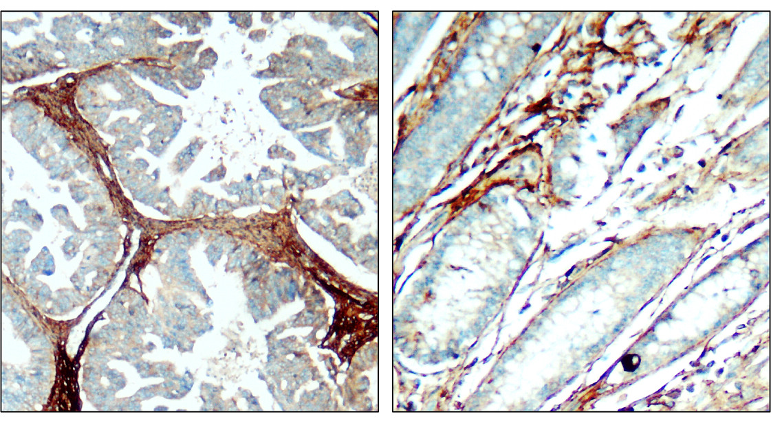 Fibronectin 1/FN1 (C-term) Antibody