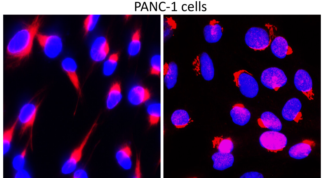 Fibronectin 1/FN1 (C-term) Antibody