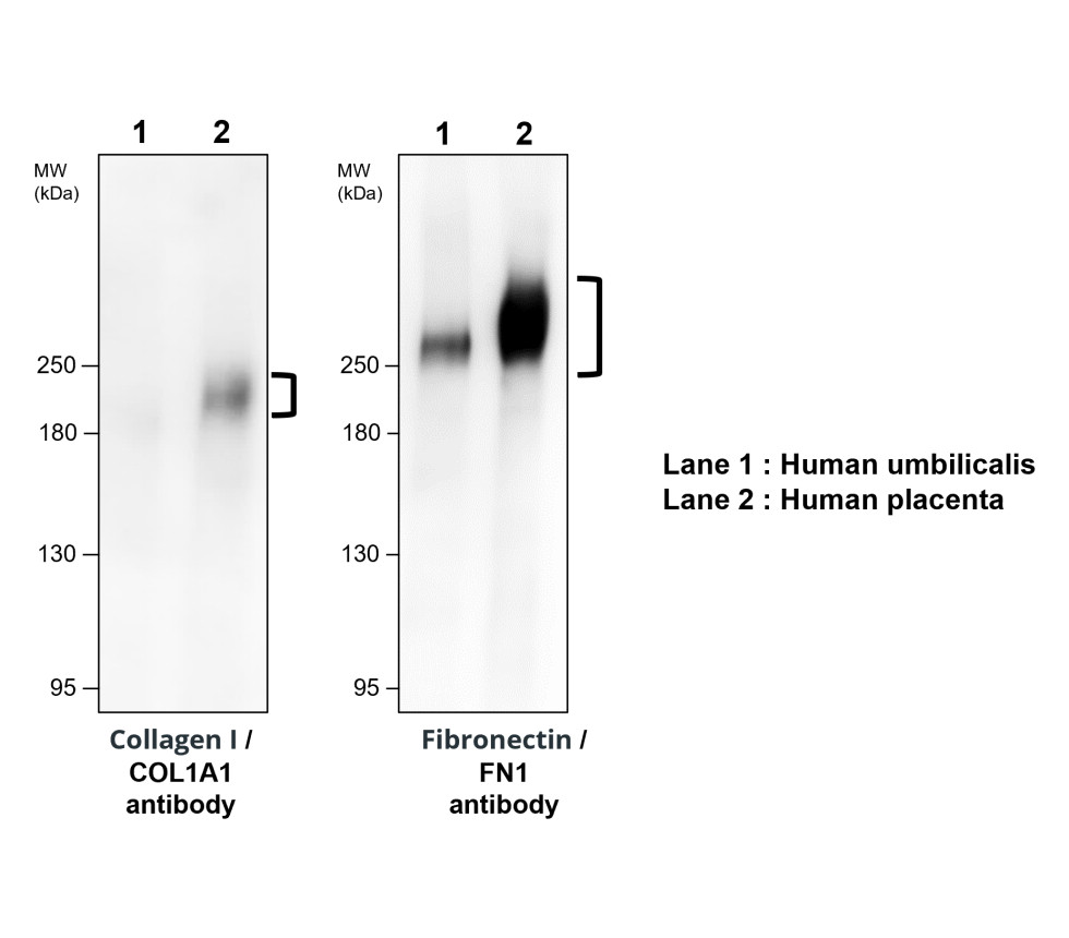 Fibronectin 1/FN1 (C-term) Antibody