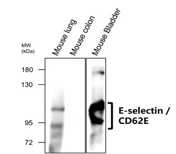 E-selectin | CD62E Antibody