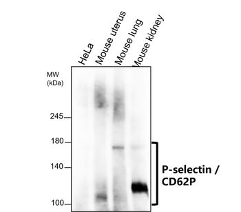 P-selectin | CD62P Antibody