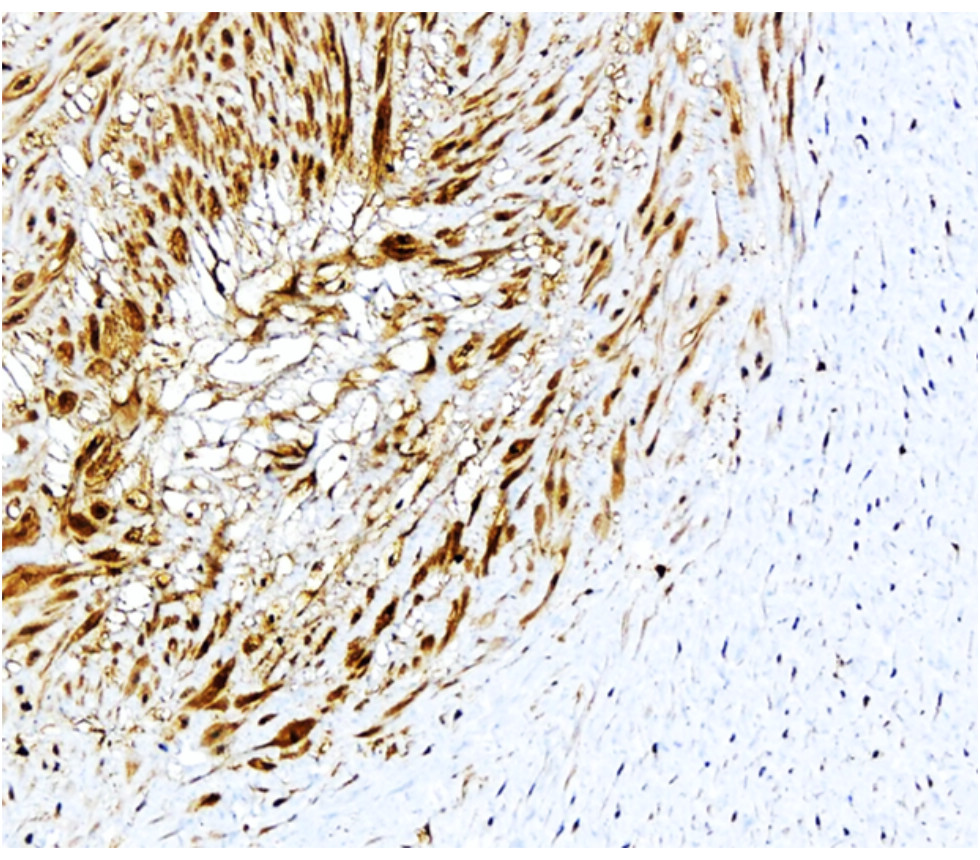 P selectin antibody