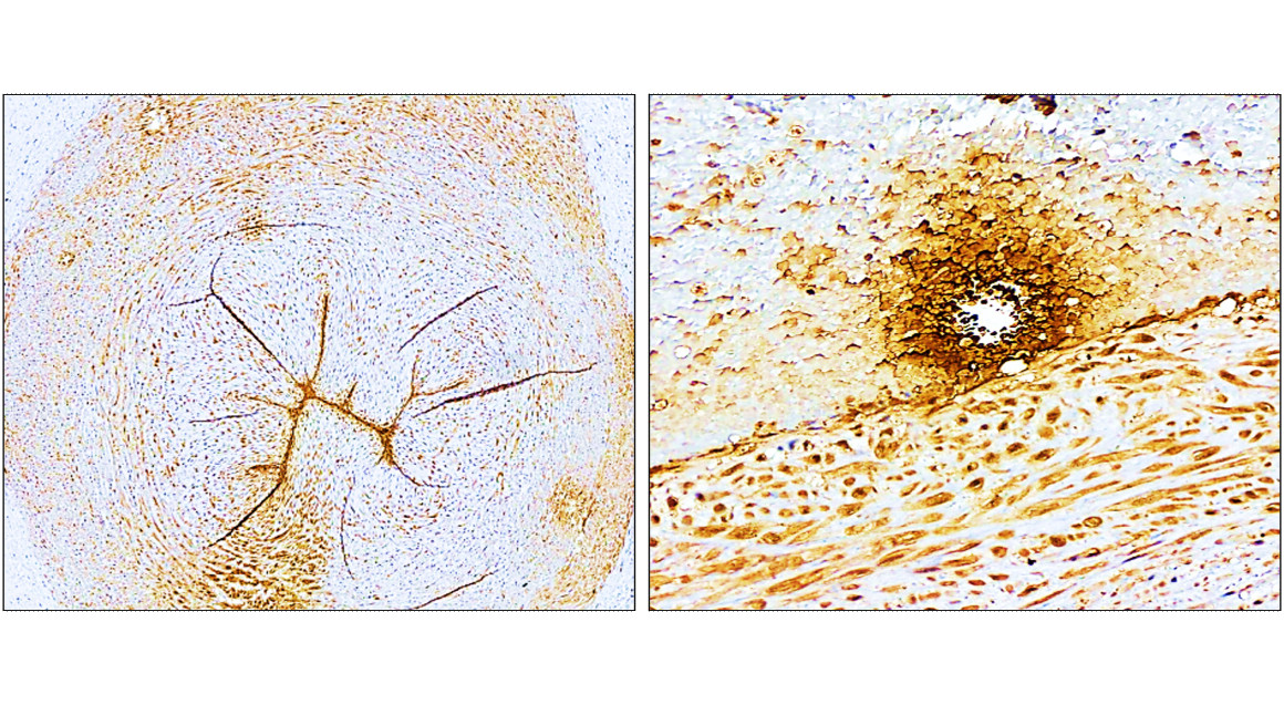 P selectin antibody