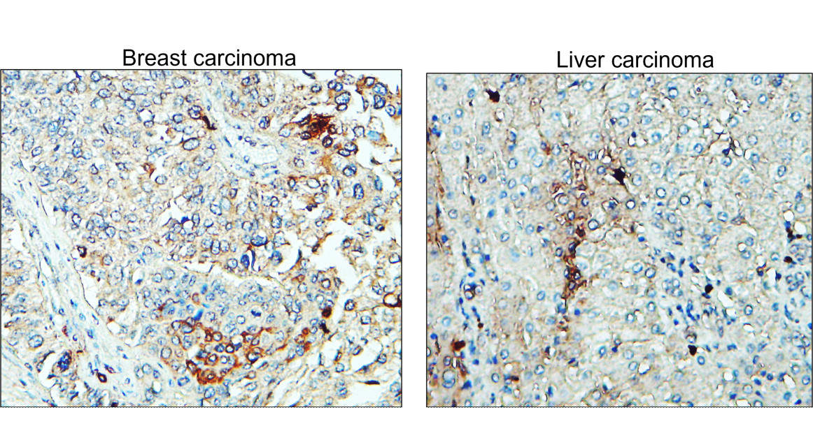 ST3GAL1/SIAT4A Antibody