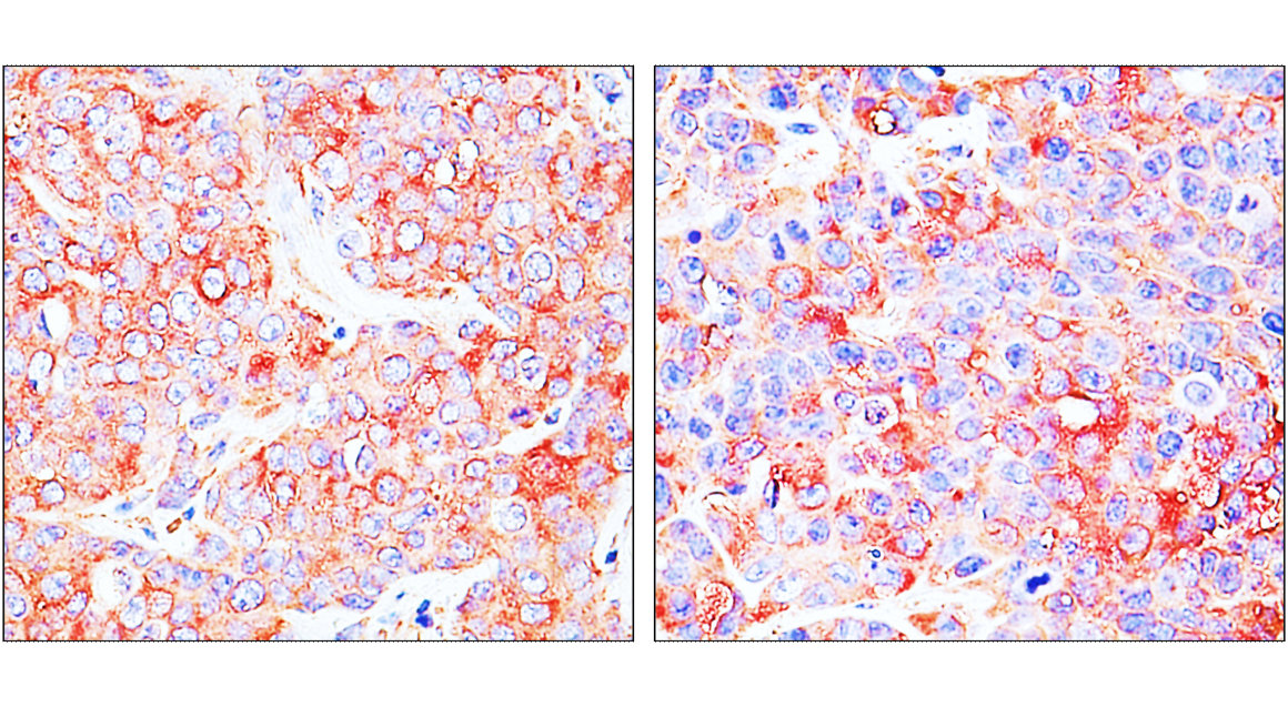 ST3GAL1/SIAT4A Antibody