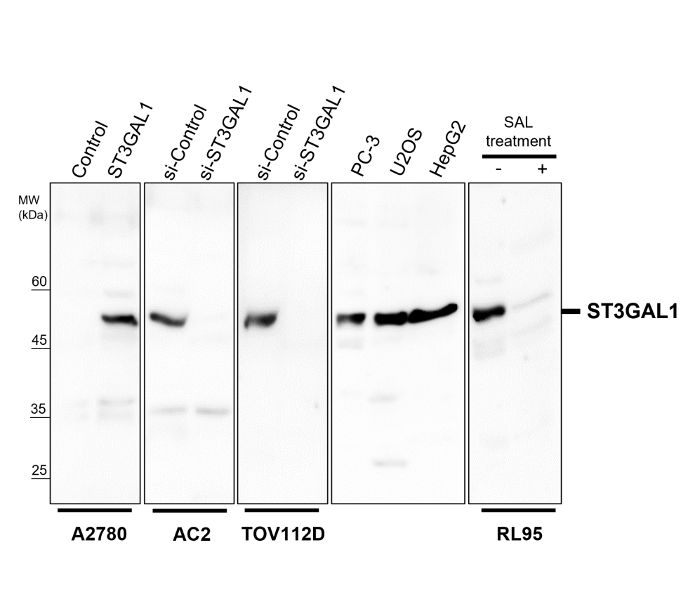 ST3GAL1/SIAT4A Antibody
