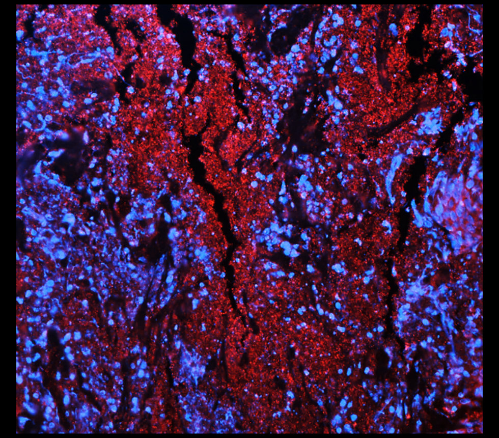 ST3GAL1/SIAT4A Antibody