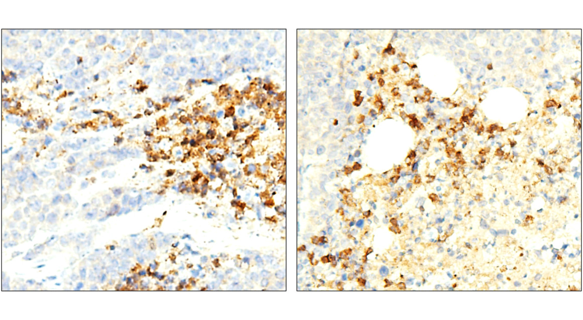 ST3GAL1/SIAT4A Antibody