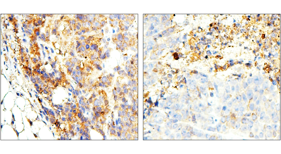 ST3GAL1/SIAT4A Antibody