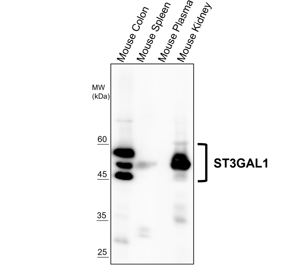 ST3GAL1 / SIAT4A