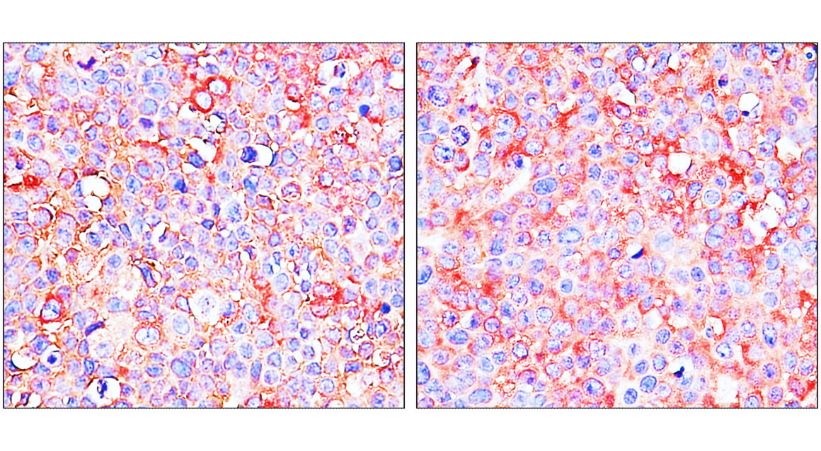 ST3GAL1/SIAT4A Antibody