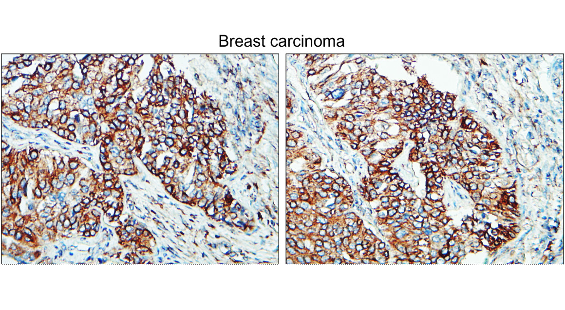 Tissue Factor / CD142 extracellular