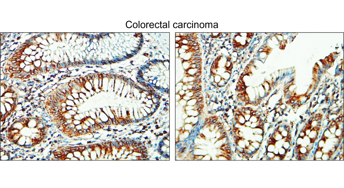 Tissue Factor antibody