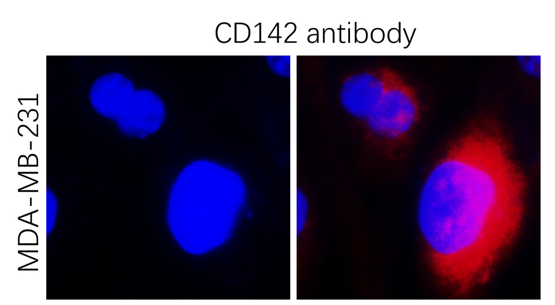 Tissue Factor / CD142 extracellular
