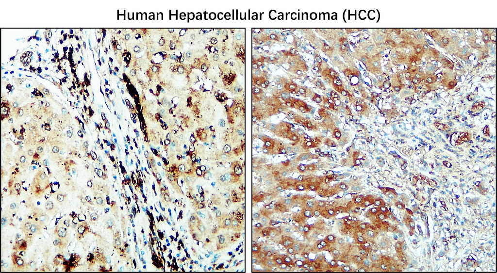 CD206/Mannose Receptor/MRC1 Antibody