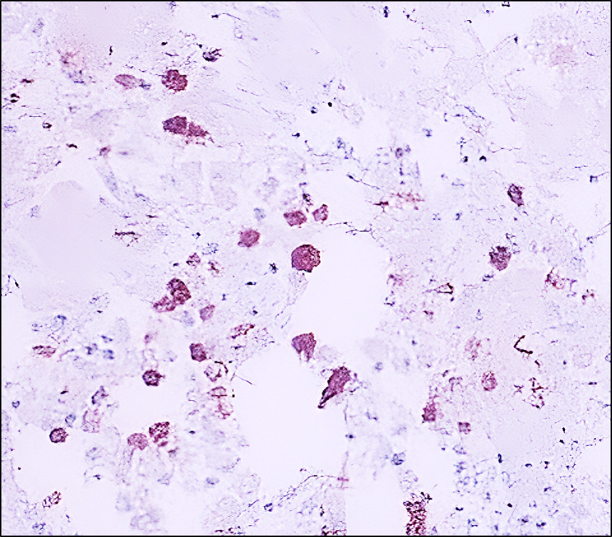 CD206/Mannose Receptor/MRC1 Antibody