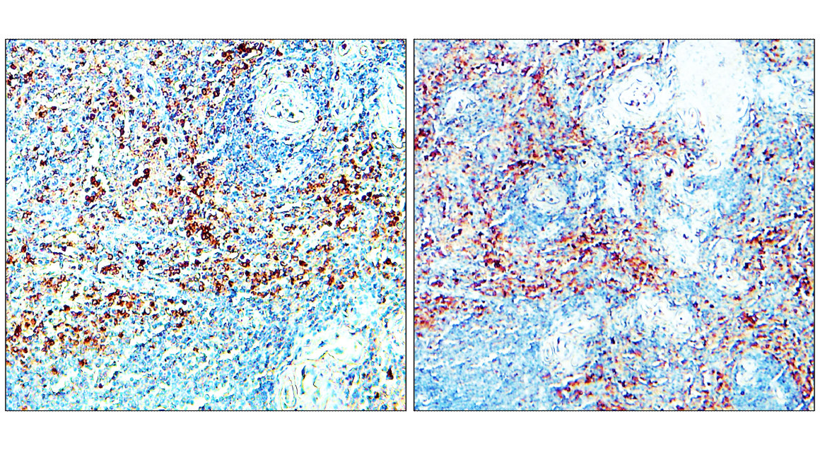 CD206 antibody