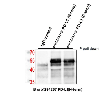 PD-L1/CD274 Extracellular domain (IHC prefer) Antibody