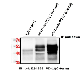 PD-L1/CD274 Intracellular domain (IHC prefer) Antibody